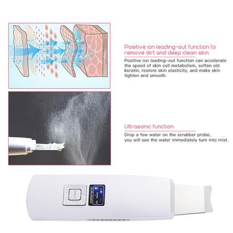 Ultrasonic Skin Scrubber – Deep Clean & Blackhead Remover