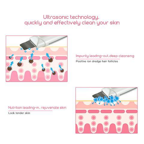 Ultrasonic Skin Scrubber – Deep Clean & Blackhead Remover